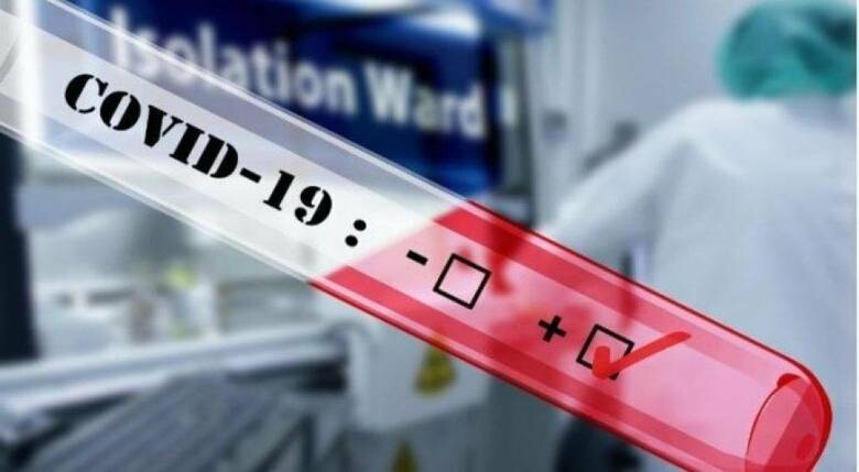 В Луганской области за сутки пять умерших от коронавируса и 228 новых случаев