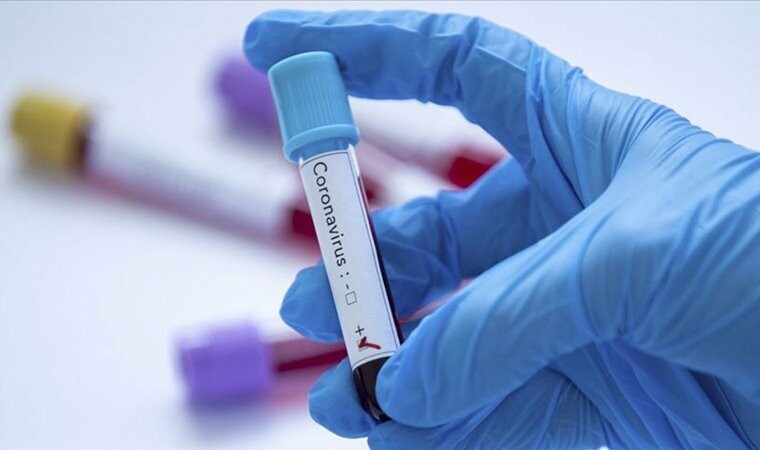 В Луганской области 74 новых случая коронавируса