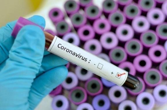 В Луганской области коронавирус унес жизни четырех человек: 213 новых случаев за сутки