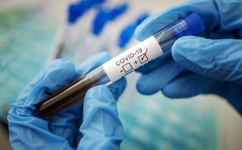 Коронавирус в ОРЛО: выявили 44 больных за сутки